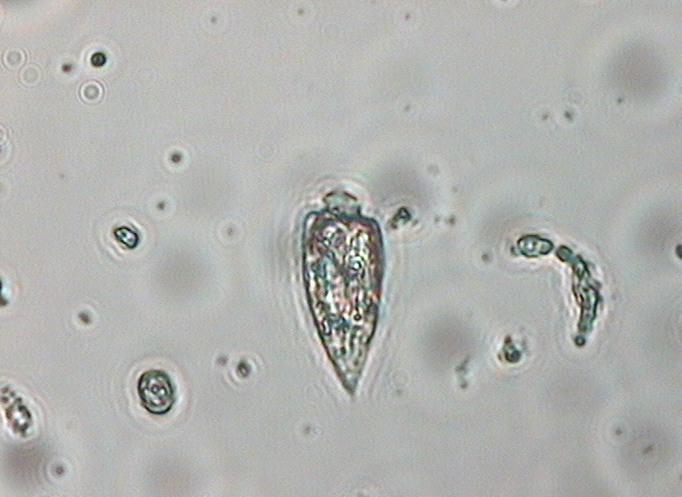 Dictyocha speculum